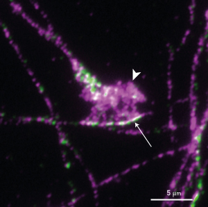 Image of the growth cone of an axon