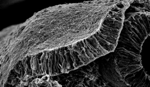Image of otic placode