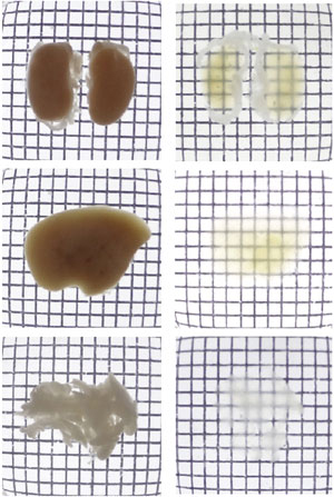 Image of mouse brains with CUBIC treament