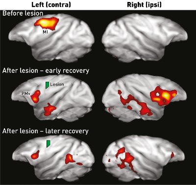 Image of monkey brains