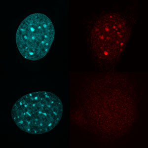 Image showing the stained DNA and trimethylation in cells