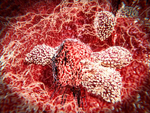 Image of T cell and cancer cell