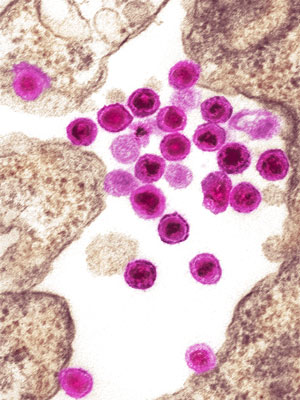 Image of mouse retrovirus