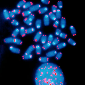 Image of telomeres on chromosomes