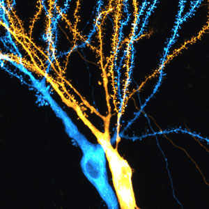 Image of dendrites of hippocampal neurons 