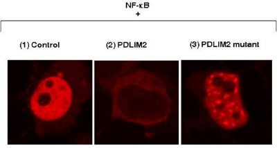 Image showing the expression of p65 in nucleus