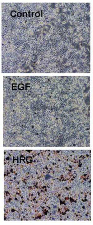 Image of of breast cancer cells treated with heregulin