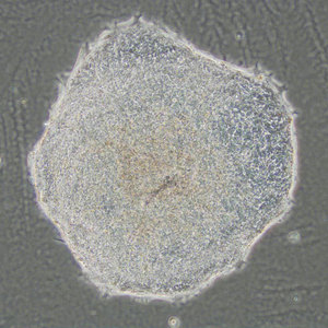 Image of Human ES cells
