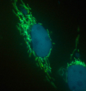 Image of mitochondria and nucleus