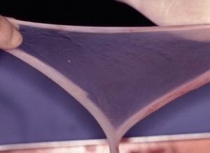 Image of amniotic membrane