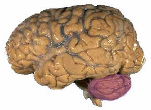 Image of a brain