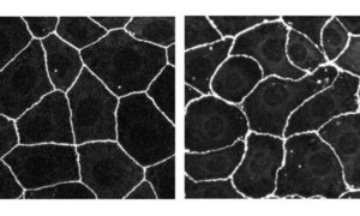 Image of honeycomb structure in epithelial cell