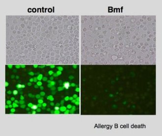 Microscopic image of B cells