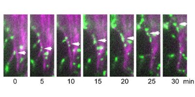 Images showing the cadherin clusters along with actin fiber