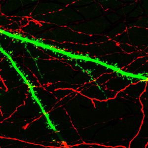 Image of neurons