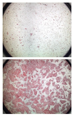 Image of hES cells with and without the treatment with ROCK inhibitor