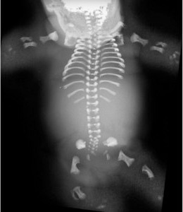 Image of a human skeleton