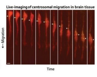Image of centrosomal migration in brain tissue