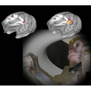 PET scan image of monkey brains