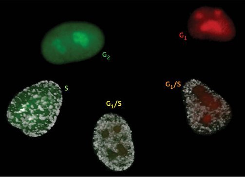 Image of stained cells in different phases