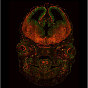 Image of stained mouse embryo