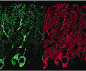 Image of Purkinje cells