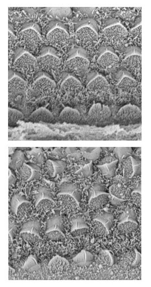Images of sensory hair cells in inner ear