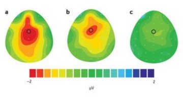 Image of EEG brain scans