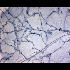 Image of a Arabidopsis leaf infected with water mold