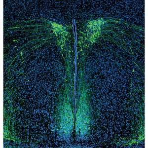 Image of vasopressin-producing neurons