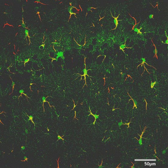 Image of astrocytes