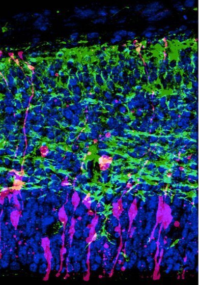 Image of neural progenitor cells