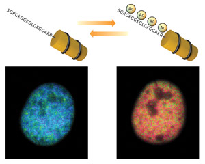 image showing the histone acetylation