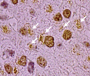 Image of islet cells expressing HMGB1 in the nucleus