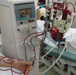 Image of hemodialysis