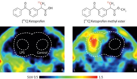PET images of rat brain after administration of Ketoprofen or Ketoprofen methyl ester