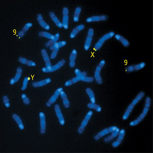 Image showing the chromosomal location of the Hiomt gene