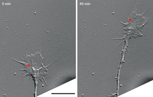 image of a neuronal growth cone