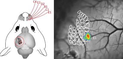 Image of a mouse brain