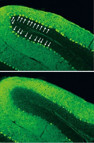 Cross-section image of cerebellum