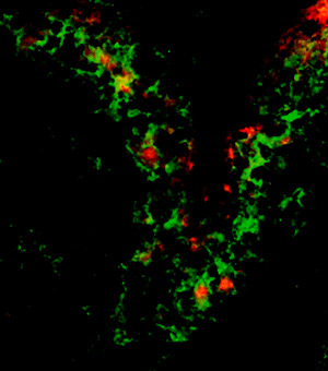 Image of CD169-positive macrophages