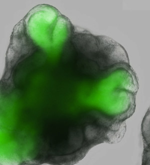 Image of optic vesicles from ESCs