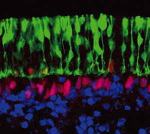 Image of neural retina layers