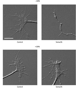 Image of axons