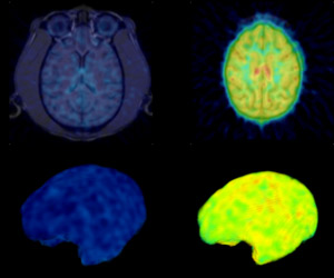 PET images of macaque brains