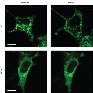 Image showing the GLUT4 localization in the cytoplasm