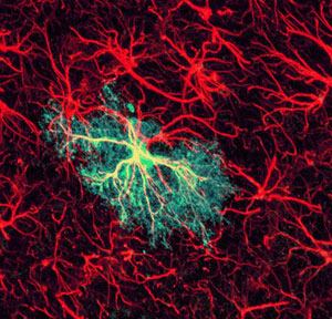 Image of astrocytes 