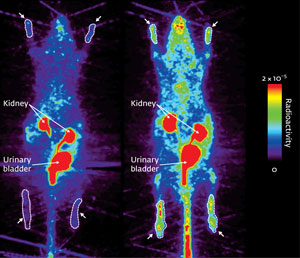 PET imaging of a rat with gout