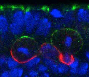 Image of neuroblasts in a Drosophila embryo