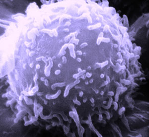Image of T cells